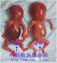 图片 19.png 图片 19.png