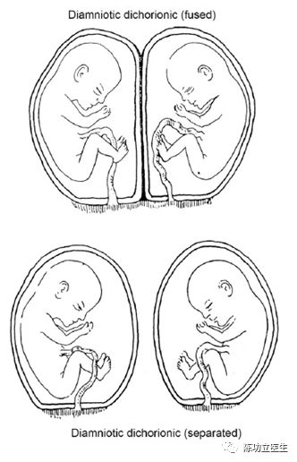 图片 21.png 图片 21.png