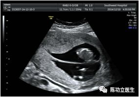 图片 26.png 图片 26.png